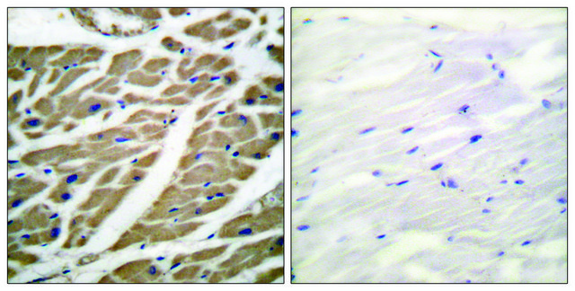 Anti-SODIUM CHANNEL-PAN antibody produced in rabbit affinity isolated antibody