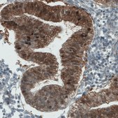 Monoclonal Anti-ASRGL1 antibody produced in mouse Prestige Antibodies&#174; Powered by Atlas Antibodies, clone CL1679, purified immunoglobulin, buffered aqueous glycerol solution