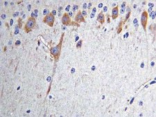Anti-Nitrotyrosine Antibody, clone 2A8.2 clone 2A8.2, Chemicon&#174;, from mouse