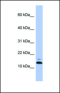 Anti-ASAH1, (N-terminal) antibody produced in rabbit affinity isolated antibody