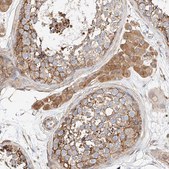 Anti-WFS1 antibody produced in rabbit Prestige Antibodies&#174; Powered by Atlas Antibodies, affinity isolated antibody, buffered aqueous glycerol solution