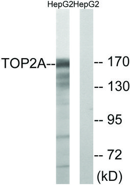 Anti-TOP2A antibody produced in rabbit affinity isolated antibody