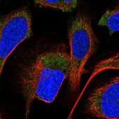 Anti-PPM1A antibody produced in rabbit Prestige Antibodies&#174; Powered by Atlas Antibodies, affinity isolated antibody, buffered aqueous glycerol solution