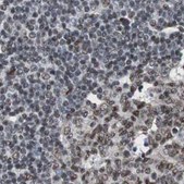 Anti-ZHX2 antibody produced in rabbit Prestige Antibodies&#174; Powered by Atlas Antibodies, affinity isolated antibody, buffered aqueous glycerol solution