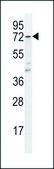 ANTI-CYP5A1 (CENTER) antibody produced in rabbit IgG fraction of antiserum, buffered aqueous solution