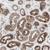 Anti-ETNK1 antibody produced in rabbit Prestige Antibodies&#174; Powered by Atlas Antibodies, affinity isolated antibody, buffered aqueous glycerol solution