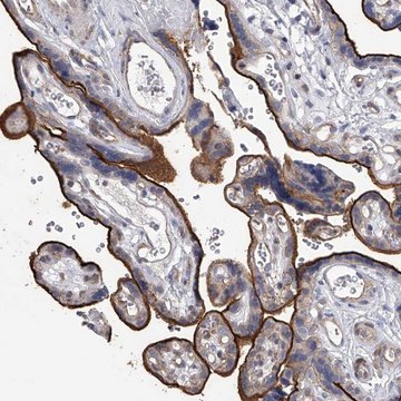 Anti-TASP1 antibody produced in rabbit Prestige Antibodies&#174; Powered by Atlas Antibodies, affinity isolated antibody, buffered aqueous glycerol solution, ab1