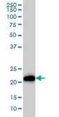 Monoclonal Anti-KRAS antibody produced in mouse clone 4F3, purified immunoglobulin, buffered aqueous solution