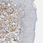 Anti-FN1 antibody produced in rabbit Prestige Antibodies&#174; Powered by Atlas Antibodies, affinity isolated antibody, buffered aqueous glycerol solution