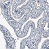 Monoclonal Anti-SOX21 antibody produced in mouse Prestige Antibodies&#174; Powered by Atlas Antibodies, clone CL4688, purified immunoglobulin