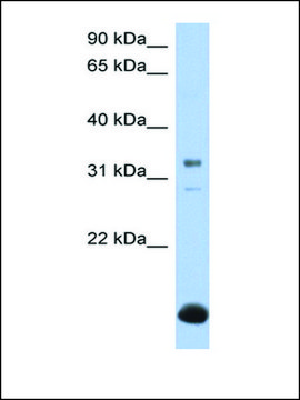 Anti-B3GALT6 (AB1) antibody produced in rabbit affinity isolated antibody