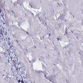 Anti-SRSF7 antibody produced in rabbit Prestige Antibodies&#174; Powered by Atlas Antibodies, affinity isolated antibody, buffered aqueous glycerol solution