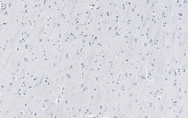 Anti-SNAP-25 Antibody, clone 1J9 ZooMAb&#174; Rabbit Monoclonal recombinant, expressed in HEK 293 cells