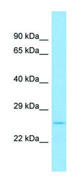 Anti-Fgf9 (N-terminal) antibody produced in rabbit affinity isolated antibody