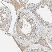 Anti-ACSL4 antibody produced in rabbit Prestige Antibodies&#174; Powered by Atlas Antibodies, affinity isolated antibody, buffered aqueous glycerol solution