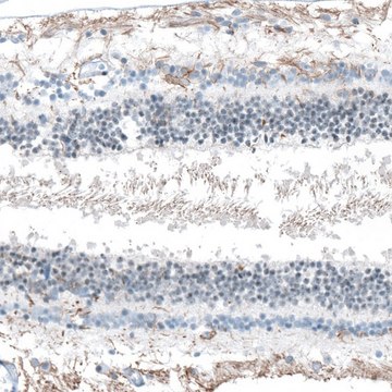 Anti-FAM161A antibody produced in rabbit Prestige Antibodies&#174; Powered by Atlas Antibodies, affinity isolated antibody, buffered aqueous glycerol solution