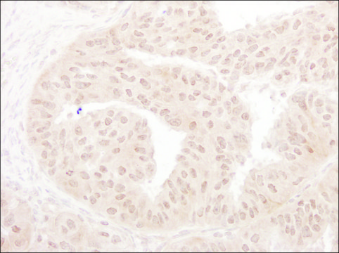 Rabbit anti-MOF/MYST1 Antibody, Affinity Purified Powered by Bethyl Laboratories, Inc.