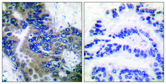 Anti-APAF-1-ALT antibody produced in rabbit affinity isolated antibody