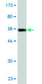 Monoclonal Anti-COL2A1 antibody produced in mouse clone 1E1, purified immunoglobulin, buffered aqueous solution