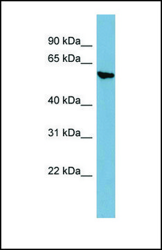 Anti-AGXT2, (N-terminal) antibody produced in rabbit affinity isolated antibody