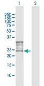 Anti-FOLR1 antibody produced in rabbit purified immunoglobulin, buffered aqueous solution