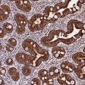 Anti-TAZ antibody produced in rabbit Prestige Antibodies&#174; Powered by Atlas Antibodies, affinity isolated antibody, buffered aqueous glycerol solution