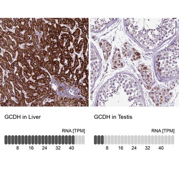 Anti-GCDH antibody produced in rabbit Prestige Antibodies&#174; Powered by Atlas Antibodies, affinity isolated antibody, buffered aqueous glycerol solution