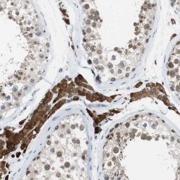 Anti-NEK4 antibody produced in rabbit Prestige Antibodies&#174; Powered by Atlas Antibodies, affinity isolated antibody, buffered aqueous glycerol solution