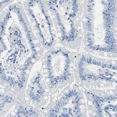 Anti-MUC7 antibody produced in rabbit Prestige Antibodies&#174; Powered by Atlas Antibodies, affinity isolated antibody, buffered aqueous glycerol solution
