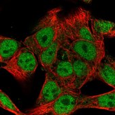 Anti-WASHC4 antibody produced in rabbit Prestige Antibodies&#174; Powered by Atlas Antibodies, affinity isolated antibody, buffered aqueous glycerol solution