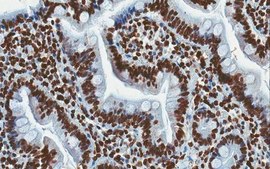 Anti-nAChR &#945;4 Subunit Antibody, clone 369 clone 369, from mouse