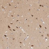 Anti-HTT antibody produced in rabbit Prestige Antibodies&#174; Powered by Atlas Antibodies, affinity isolated antibody, buffered aqueous glycerol solution