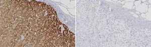 Anti-CYP11A1 Antibody, clone 2M5 ZooMAb&#174; Rabbit Monoclonal recombinant, expressed in HEK 293 cells