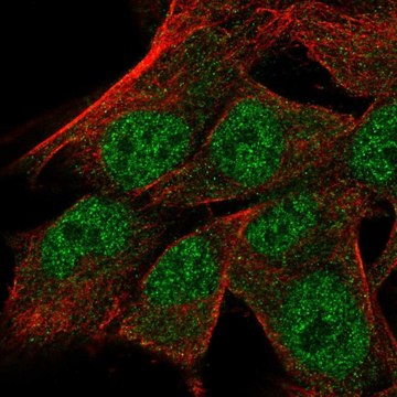 Anti-TRNAU1AP antibody produced in rabbit Prestige Antibodies&#174; Powered by Atlas Antibodies, affinity isolated antibody
