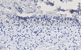 Anti-HSP70 Antibody, clone 4E12 ZooMAb&#174; Rabbit Monoclonal recombinant, expressed in HEK 293 cells