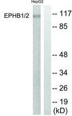 Anti-EPHB1 antibody produced in rabbit affinity isolated antibody