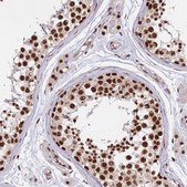 Anti-PRKDC antibody produced in rabbit Prestige Antibodies&#174; Powered by Atlas Antibodies, affinity isolated antibody, buffered aqueous glycerol solution