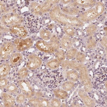 Anti-SLC34A1 antibody produced in rabbit Prestige Antibodies&#174; Powered by Atlas Antibodies, affinity isolated antibody, buffered aqueous glycerol solution