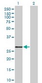 Anti-PRSS2 antibody produced in rabbit purified immunoglobulin, buffered aqueous solution