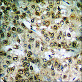Anti-phospho-STAT3 (pSer727) antibody produced in rabbit affinity isolated antibody