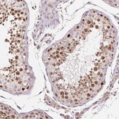 Anti-PIWIL4 antibody produced in rabbit Prestige Antibodies&#174; Powered by Atlas Antibodies, affinity isolated antibody, buffered aqueous glycerol solution