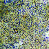 Anti-phospho-FOXO1A (pSer329) antibody produced in rabbit affinity isolated antibody