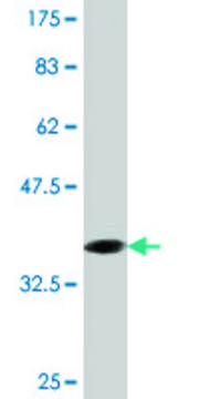 Monoclonal Anti-CRYGD, (C-terminal) antibody produced in mouse clone 2H3, purified immunoglobulin, buffered aqueous solution