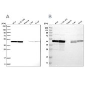 Anti-TUFM antibody produced in rabbit Prestige Antibodies&#174; Powered by Atlas Antibodies, affinity isolated antibody, buffered aqueous glycerol solution