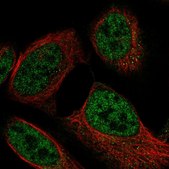 Anti-MLST8 antibody produced in rabbit Prestige Antibodies&#174; Powered by Atlas Antibodies, affinity isolated antibody, buffered aqueous glycerol solution
