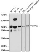 Anti-GPA33 Antibody, clone 9W5A7, Rabbit Monoclonal