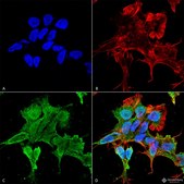 Monoclonal Anti-Versican - Rpe antibody produced in mouse clone S351-23, purified immunoglobulin