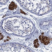 Anti-CYP51A1 antibody produced in rabbit Prestige Antibodies&#174; Powered by Atlas Antibodies, affinity isolated antibody, buffered aqueous glycerol solution
