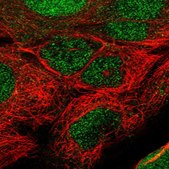 Anti-TET1 antibody produced in rabbit Prestige Antibodies&#174; Powered by Atlas Antibodies, affinity isolated antibody