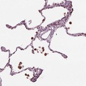 Anti-NUP210 antibody produced in rabbit Prestige Antibodies&#174; Powered by Atlas Antibodies, affinity isolated antibody, buffered aqueous glycerol solution